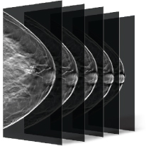 Breast tomosynthesis images