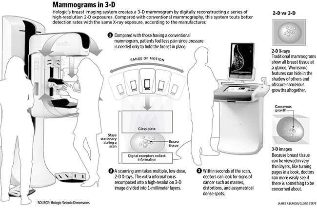 Mammograms in 3D - The Boston Globe